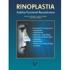 RINOPLASTIA - ESTÉTICA-FUNCIONAL-RECONSTRUTORA