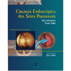 CIRURGIA ENDOSCÓPICA DOS SEIOS PARANASAIS