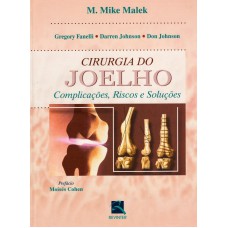 CIRURGIA DO JOELHO - COMPLICAÇÕES,RISCOS E SOLUÇÕES