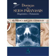 DOENÇAS DOS SEIOS PARANASAIS: DIAGNÓSTICO E TRATAMENTO