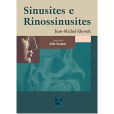 SINUSITES E RINOSSINUSITES