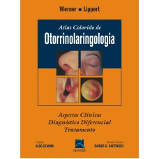 ATLAS COLORIDO DE OTORRINOLARINGOLOGIA: ASPECTOS CLÍNICOS, DIAGNÓSTICO DIFERENCIAL E TRATAMENTO