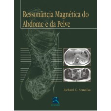 RESSONÂNCIA MAGNÉTICA DO ABDOME E DA PELVE