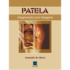 PATELA - DIAGNÓSTICO POR IMAGEM