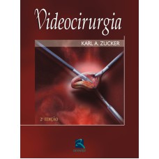 VIDEOCIRURGIA