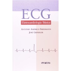 ECG ELETROCARDIOLOGIA BÁSICA