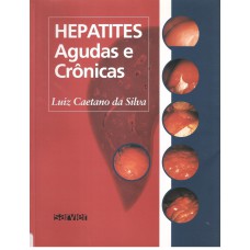 HEPATITES AGUDAS E CRÔNICAS