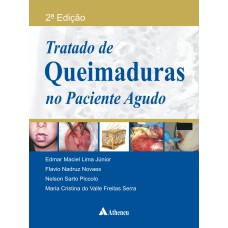 TRATADO DE QUEIMADURAS NO PACIENTE AGUDO