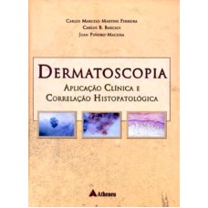 DERMATOSCOPIA - APLICAÇÃO CLÍNICA E CORRELAÇÃO HISTOPATOLÓGICA