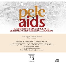 PELE E AIDS: MANIFESTACOES DERMATOLOGICAS NA SINDROME DA IMUNODEFICIENCIA A - 1