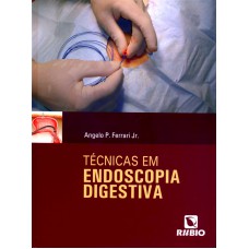 TECNICAS EM ENDOSCOPIA DIGESTIVA