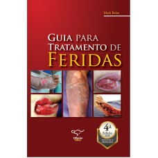 GUIA PARA TRATAMENTO DE FERIDAS