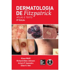 DERMATOLOGIA DE FITZPATRICK: ATLAS E TEXTO