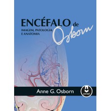 ENCÉFALO DE OSBORN: IMAGEM, PATOLOGIA E ANATOMIA