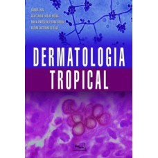 DERMATOLOGIA TROPICAL