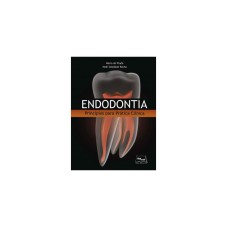 ENDODONTIA - PRINCÍPIOS PARA PRÁTICA CLÍNICA