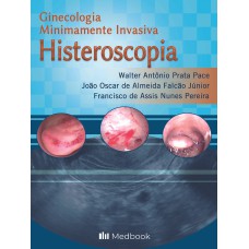 HISTEROSCOPIA - GINECOLOGIA MINIMAMENTE INVASIVA