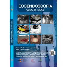 ECOENDOSCOPIA COMO EU FAÇO?