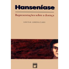 HANSENÍASE - REPRESENTAÇÕES SOBRE A DOENÇA