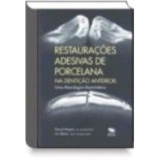 RESTAURACOES ADESIVAS DE PORCELANA NA DENTICAO ANTERIOR