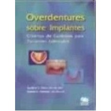 OVERDENTURES SOBRE IMPLANTES - CRITERIOS E CUIDADOS