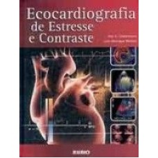 ECOCARDIOGRAFIA DE ESTRESSE E CONTRASTE