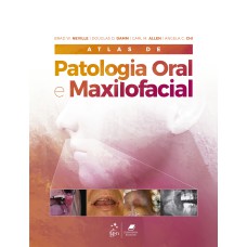 ATLAS DE PATOLOGIA ORAL E MAXILOFACIAL